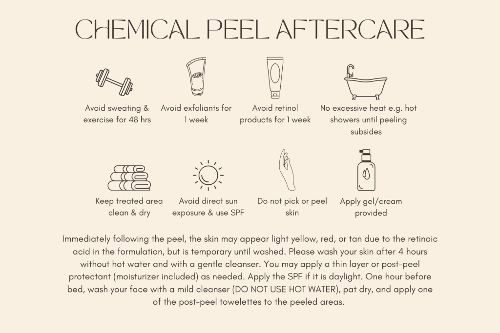 Chemical Peel Aftercare Athens, GA